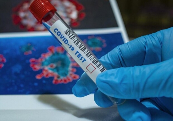 Умершие только в нашей области: какая статистика Covid-19 в Одесском регионе сегодня